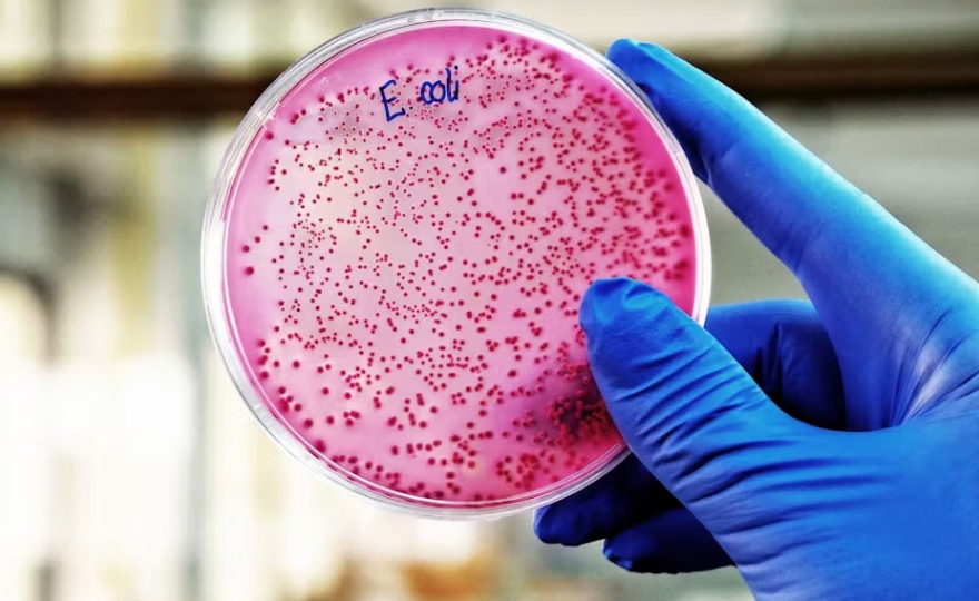 Aliments contaminés par la bactérie « E. coli » : quels effets sur la santé et comment prévenir les infections ?